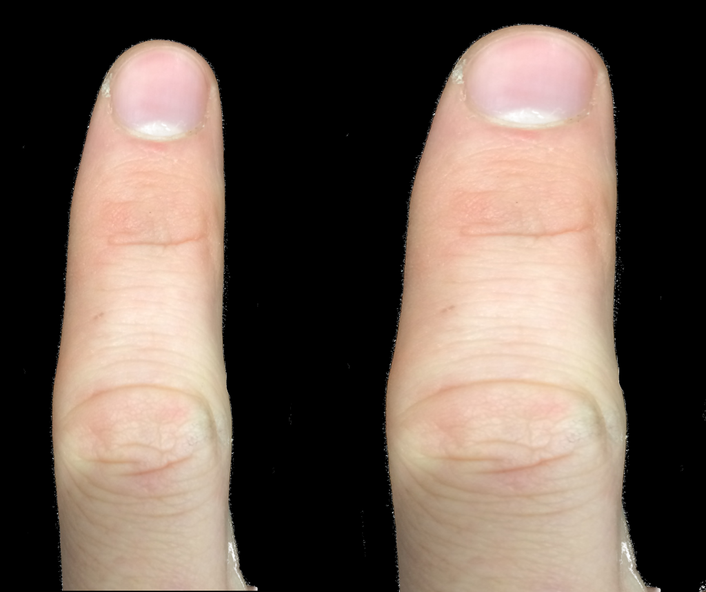 Anaesthesia makes us feel fat, not big