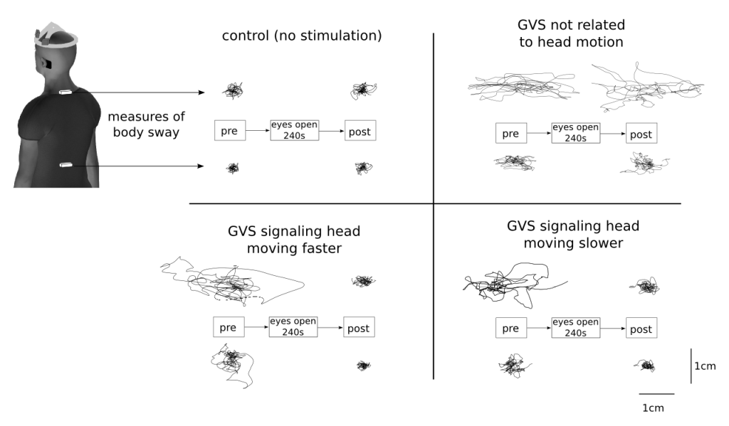 Figure 2. Example of large sway with galvanic vestibular stimulation (GVS) when eyes are closed (pre). After a period with the eyes open (240s), sway returned to baseline levels (control) when the subject closed their eyes (post) if the vestibular stimulation was coupled to head motion. 